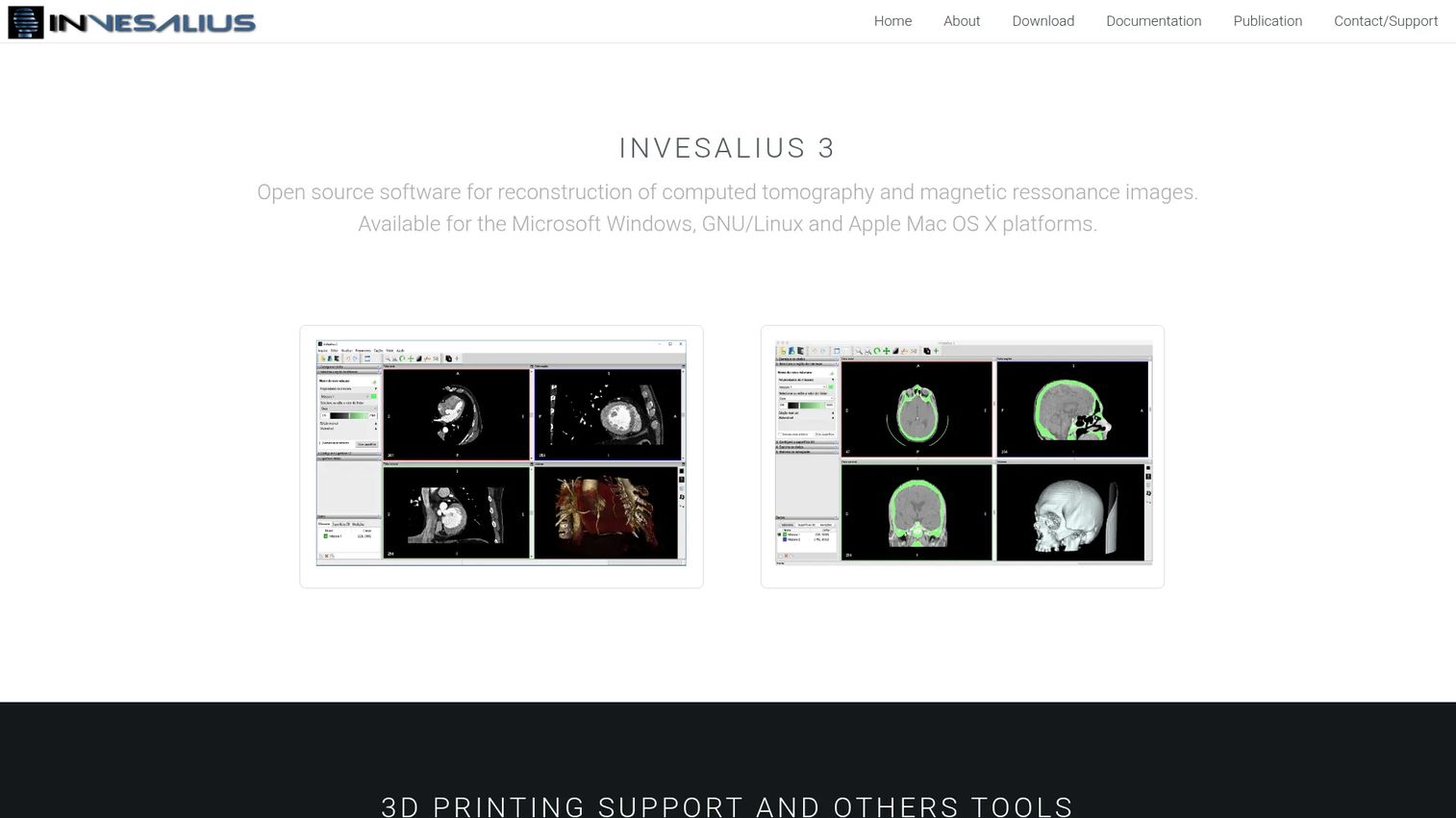 InVesalius 3D reconstruction software homepage