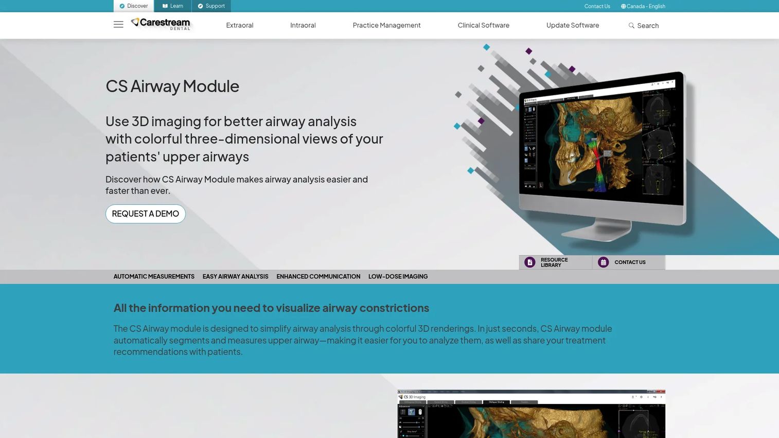 CS Airway Module airway analysis software